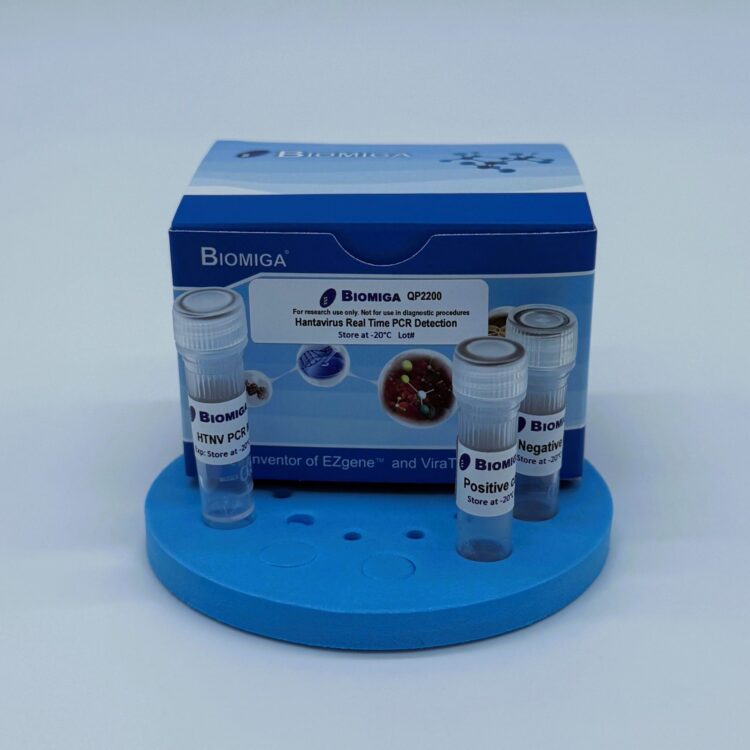 Hantavirus Real Time PCR Detection